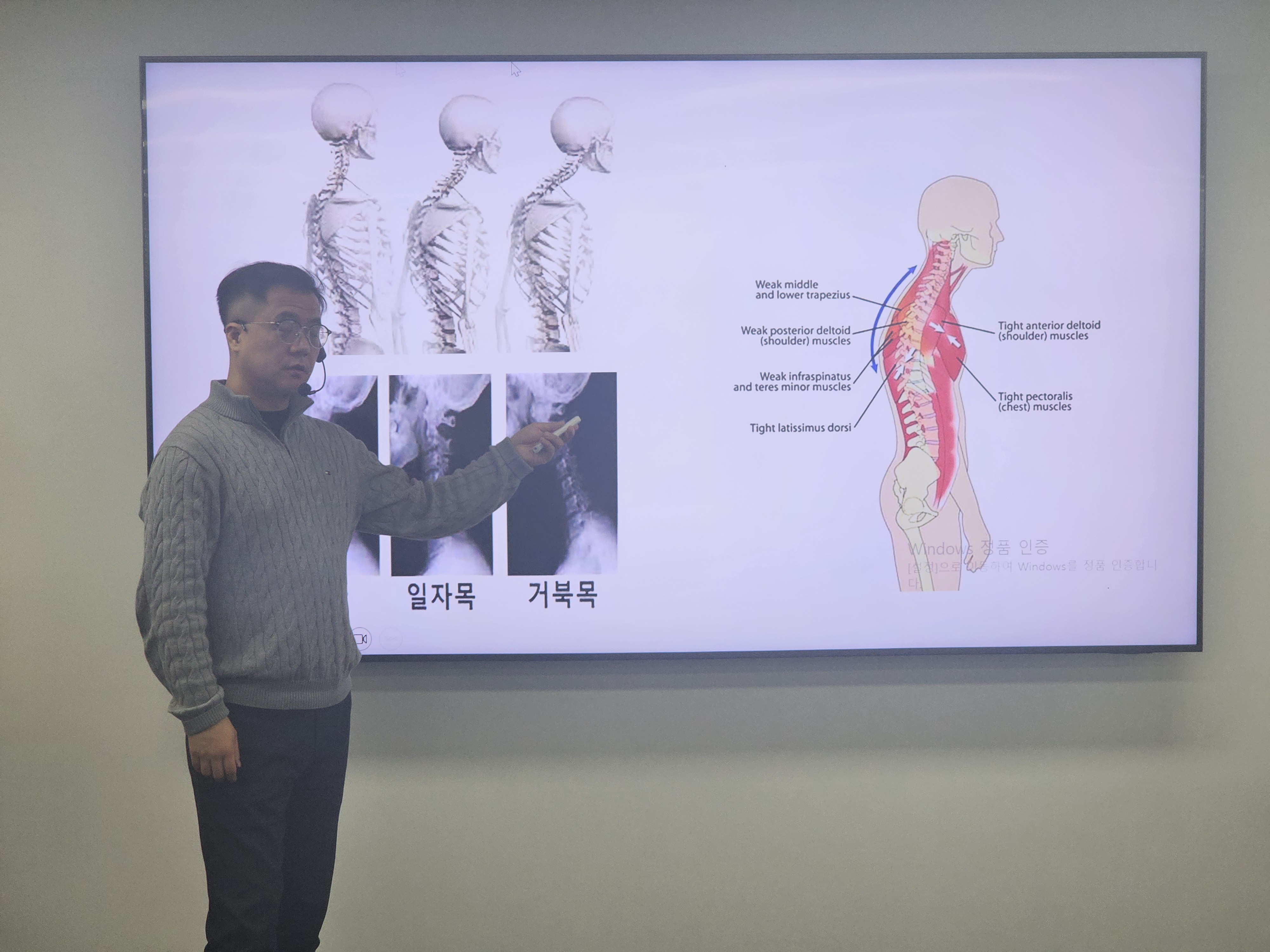 정상, 일자목, 거북목 비교 분석